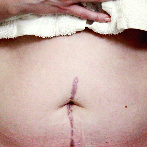 Postpartum Renewal 